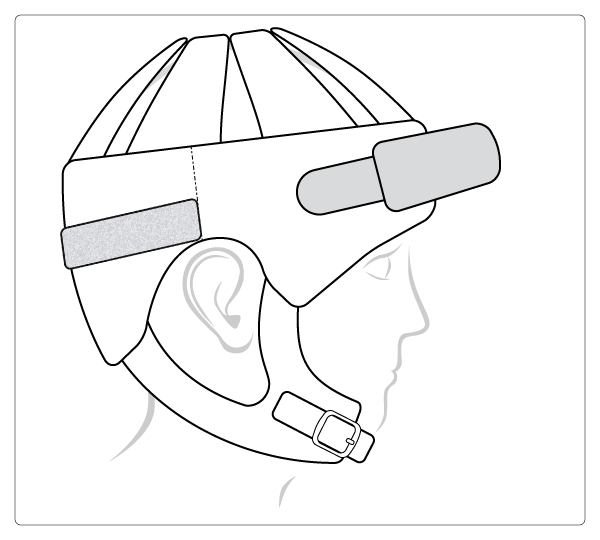 Stirnschutz Stirnschutz